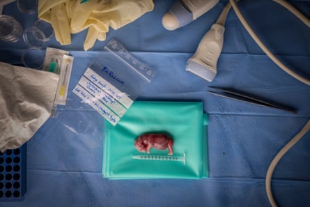 White rhino foetus, surrounded by mediacl equipment, the result of the first successful rhino embryo transfer into a surrogate mother through IVF