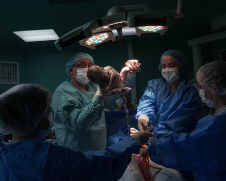 A doctor holds up a newborn baby, umbilicus still attached, after performing a caesarean section on her mother with nurses supporting in an operating theatre.